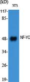 Nuclear transcription factor Y subunit gamma antibody, A06128, Boster Biological Technology, Western Blot image 