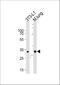Charged Multivesicular Body Protein 3 antibody, A04800, Boster Biological Technology, Western Blot image 
