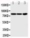 Neurotrophic Receptor Tyrosine Kinase 1 antibody, LS-C343938, Lifespan Biosciences, Western Blot image 