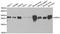 NSF Attachment Protein Gamma antibody, STJ28515, St John