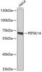 Phosphatidylinositol-4-Phosphate 5-Kinase Type 1 Alpha antibody, GTX33411, GeneTex, Western Blot image 
