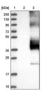 Potassium Two Pore Domain Channel Subfamily K Member 1 antibody, PA5-53413, Invitrogen Antibodies, Western Blot image 