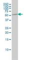 Tubulin Alpha 1b antibody, H00010376-M01, Novus Biologicals, Western Blot image 