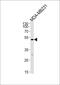 MHC Class I Polypeptide-Related Sequence A antibody, PA5-35346, Invitrogen Antibodies, Western Blot image 