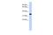 Actin Related Protein T1 antibody, A17173, Boster Biological Technology, Western Blot image 