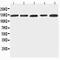 Integrin alpha-7 antibody, PA2226, Boster Biological Technology, Western Blot image 