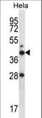 RAD23 Homolog A, Nucleotide Excision Repair Protein antibody, LS-C162406, Lifespan Biosciences, Western Blot image 