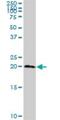 TRNA Splicing Endonuclease Subunit 15 antibody, H00116461-D01P, Novus Biologicals, Western Blot image 