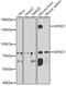 Nuclear Receptor Binding SET Domain Protein 2 antibody, GTX64491, GeneTex, Western Blot image 