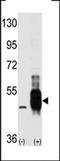 Mitogen-Activated Protein Kinase Kinase Kinase 8 antibody, MBS9211367, MyBioSource, Western Blot image 