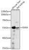 Retinoid X Receptor Alpha antibody, LS-C750212, Lifespan Biosciences, Western Blot image 
