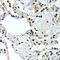 General Transcription Factor IIF Subunit 1 antibody, 18-663, ProSci, Immunohistochemistry paraffin image 