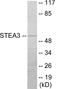 STEAP3 Metalloreductase antibody, EKC1854, Boster Biological Technology, Western Blot image 