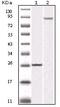 Inhibitor Of Nuclear Factor Kappa B Kinase Subunit Beta antibody, MA5-15319, Invitrogen Antibodies, Western Blot image 