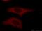 Tubulin Alpha 1a antibody, 14555-1-AP, Proteintech Group, Immunofluorescence image 