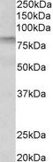 Transglutaminase-3 antibody, TA309514, Origene, Western Blot image 