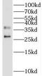 Uracil DNA Glycosylase antibody, FNab09265, FineTest, Western Blot image 