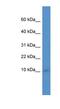 Immediate Early Response 3 Interacting Protein 1 antibody, NBP1-91302, Novus Biologicals, Western Blot image 