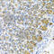 WAP Four-Disulfide Core Domain 2 antibody, A6788, ABclonal Technology, Immunohistochemistry paraffin image 