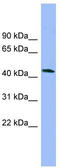 N-Terminal EF-Hand Calcium Binding Protein 3 antibody, TA344661, Origene, Western Blot image 