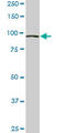 Vacuolar protein sorting-associated protein 18 homolog antibody, LS-C139436, Lifespan Biosciences, Western Blot image 