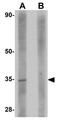Spindle And Kinetochore Associated Complex Subunit 2 antibody, GTX85247, GeneTex, Western Blot image 