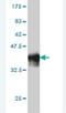 Scm Polycomb Group Protein Homolog 1 antibody, H00022955-M01, Novus Biologicals, Western Blot image 