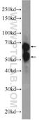 Guanylate Binding Protein 5 antibody, 13220-1-AP, Proteintech Group, Western Blot image 