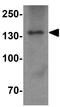 Partner And Localizer Of BRCA2 antibody, GTX85263, GeneTex, Western Blot image 
