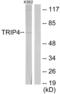 Thyroid Hormone Receptor Interactor 4 antibody, abx013627, Abbexa, Western Blot image 