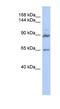 G Protein-Coupled Receptor Associated Sorting Protein 2 antibody, NBP1-56710, Novus Biologicals, Western Blot image 