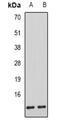 Alpha Hemoglobin Stabilizing Protein antibody, abx141344, Abbexa, Western Blot image 