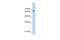 Poly(ADP-Ribose) Polymerase Family Member 6 antibody, GTX47710, GeneTex, Western Blot image 