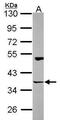 Homer Scaffold Protein 3 antibody, TA308627, Origene, Western Blot image 