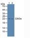 Proteasome Subunit Beta 8 antibody, LS-C295095, Lifespan Biosciences, Western Blot image 