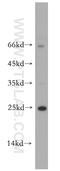 RAS Like Estrogen Regulated Growth Inhibitor antibody, 10687-1-AP, Proteintech Group, Western Blot image 