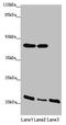 Zinc Finger DHHC-Type Containing 16 antibody, LS-C676734, Lifespan Biosciences, Western Blot image 
