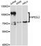 Nuclear Factor, Erythroid 2 Like 2 antibody, LS-C331384, Lifespan Biosciences, Western Blot image 