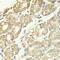 Catenin Delta 1 antibody, LS-C331607, Lifespan Biosciences, Immunohistochemistry paraffin image 