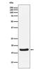 Troponin C, slow skeletal and cardiac muscles antibody, M03153-1, Boster Biological Technology, Western Blot image 