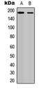 Erb-B2 Receptor Tyrosine Kinase 4 antibody, LS-C356027, Lifespan Biosciences, Western Blot image 