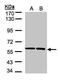 SRP Receptor Subunit Alpha antibody, PA5-28295, Invitrogen Antibodies, Western Blot image 