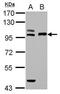 Transferrin Receptor 2 antibody, PA5-29137, Invitrogen Antibodies, Western Blot image 