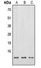 Neuromedin B antibody, GTX55995, GeneTex, Western Blot image 