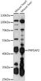 Phosphoribosyl Pyrophosphate Synthetase Associated Protein 2 antibody, 16-194, ProSci, Western Blot image 