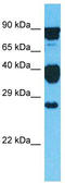 GLIPR1 Like 2 antibody, TA330807, Origene, Western Blot image 