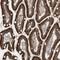 Zinc Finger Protein 354C antibody, HPA030904, Atlas Antibodies, Immunohistochemistry paraffin image 