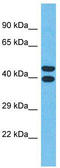 Olfactory Receptor Family 4 Subfamily Q Member 3 antibody, TA337509, Origene, Western Blot image 