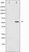 Peroxisome Proliferator Activated Receptor Gamma antibody, TA327806, Origene, Western Blot image 