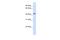 Pyruvate Dehydrogenase Kinase 3 antibody, A05658, Boster Biological Technology, Western Blot image 